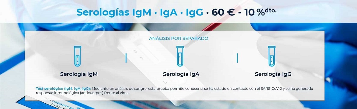 Pruebas de covid-19 serología